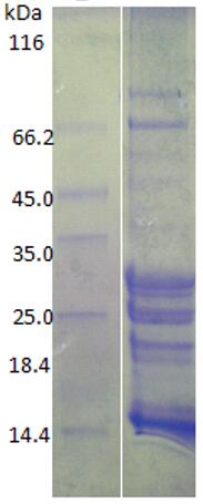 15% SDS-PAGE analysis profiles of purified AB57_3582-22-253 (CBB stained)